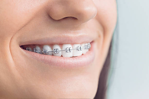 Best Dentures (Full and Partial)  in Atwater, CA